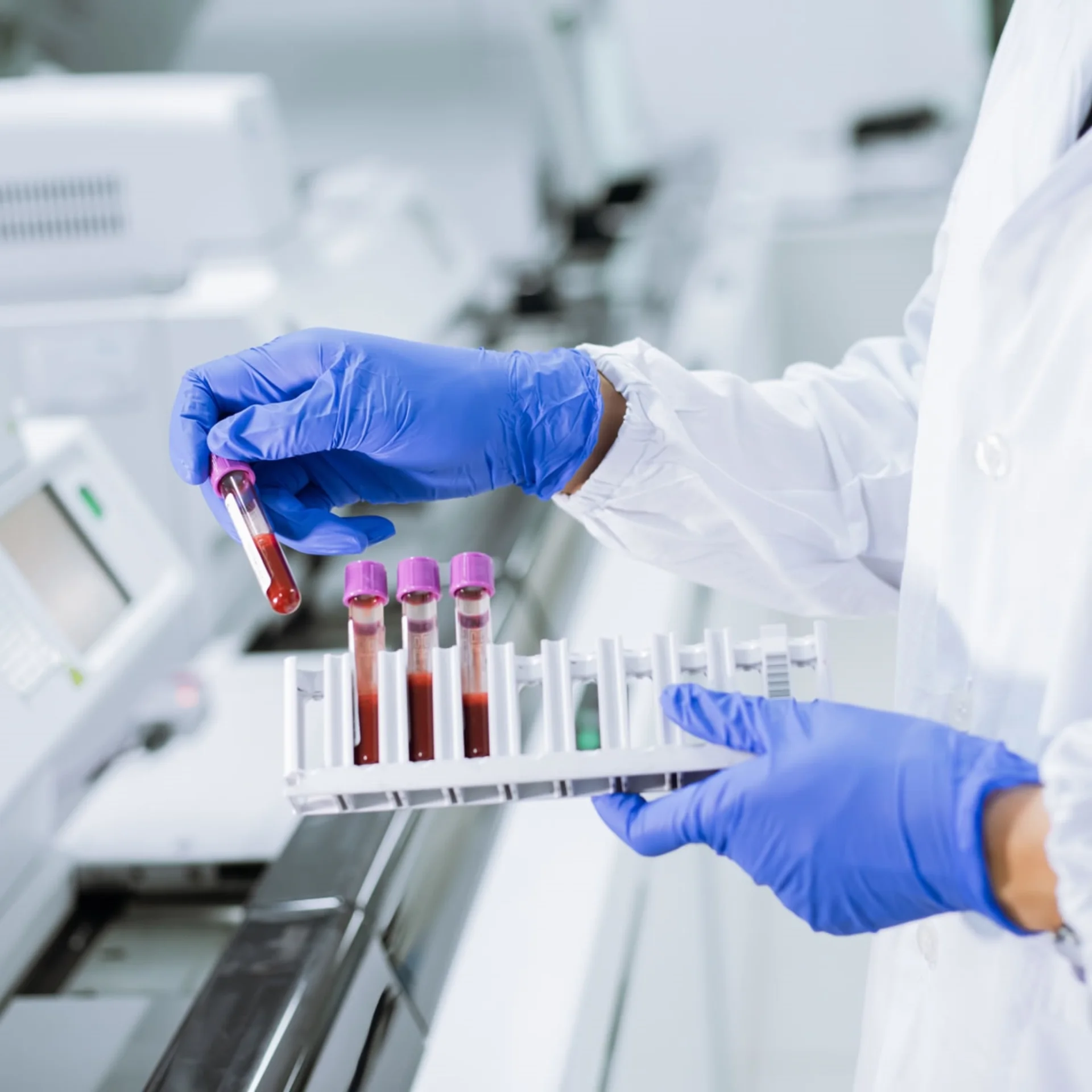 Hematología