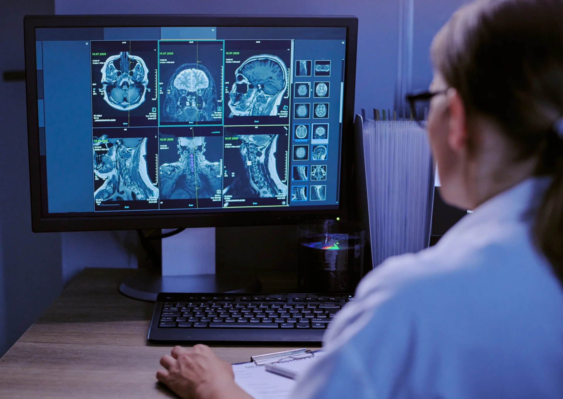 Neurología consulta