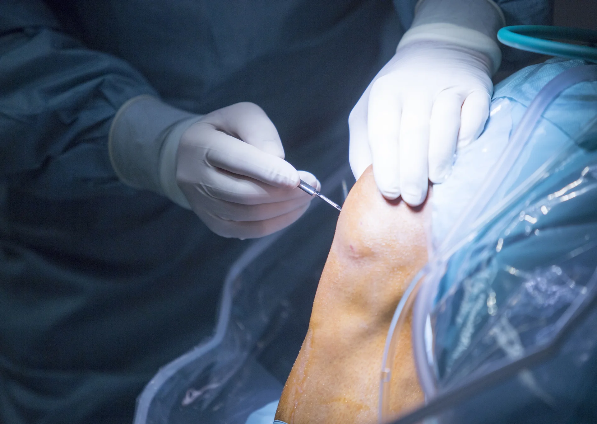 Traumatología consulta