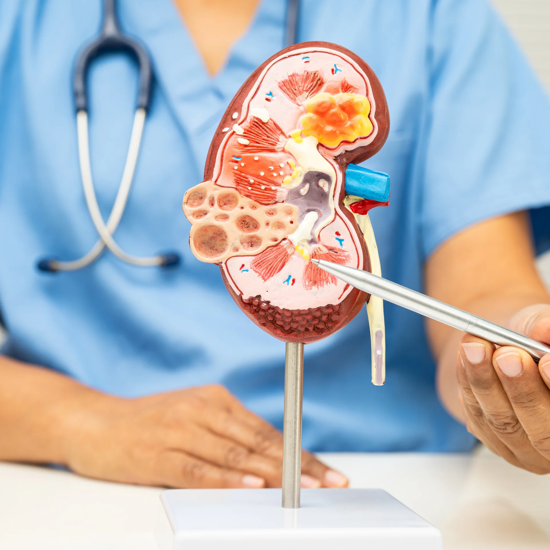 Urología